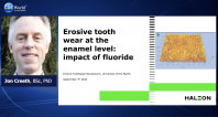 Spotlight on Erosive Tooth Wear - Part 2: Impact of Fluoride at the Enamel Level Webinar Thumbnail